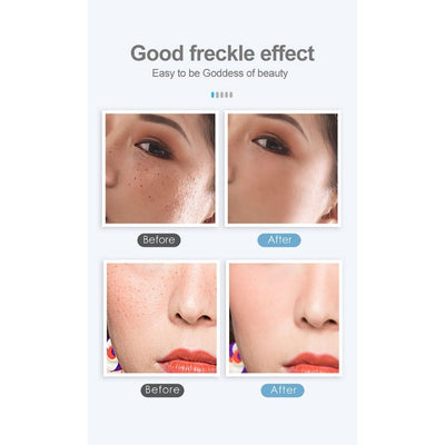 Freckle Remove Pen