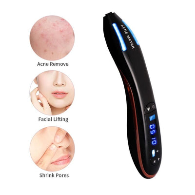 Acne Removal Plasma Pen