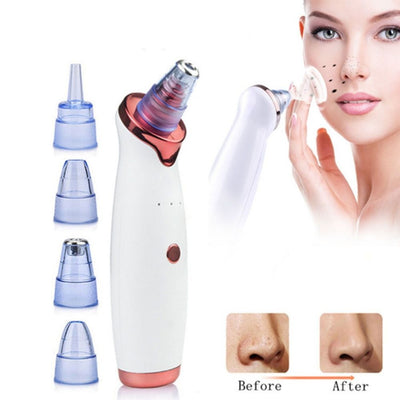 Blackhead Electric Vacuum Remover